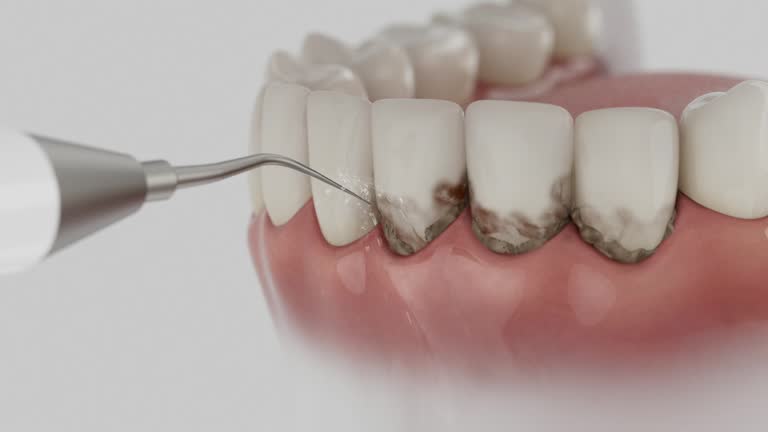 Trusted Teeth Cleaning And Checkup service in Kansas City, MO - Dentist Open Now